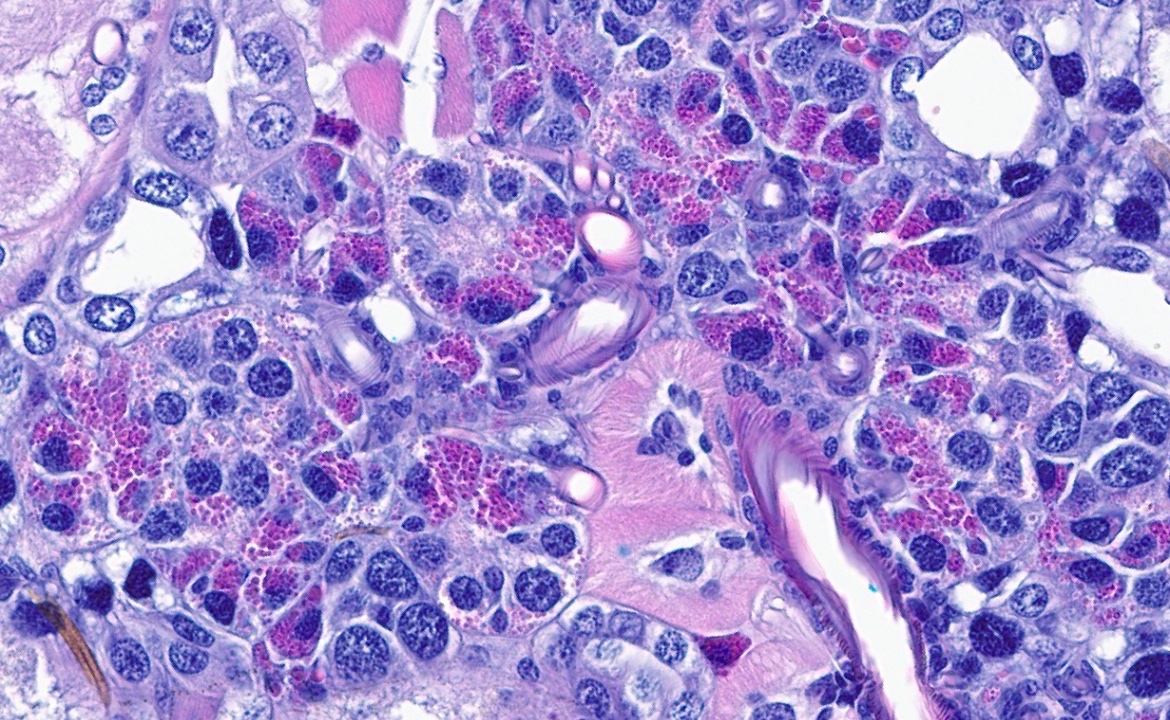 CakePath's tweet image. Alright, we have this cutie 🥰 ! 
I now have a better idea of the potential organ identification from this entomological autopsy. #pathology #pathologists #pathTwitter #dermpath #dermatologia #dermtwitter #entomology