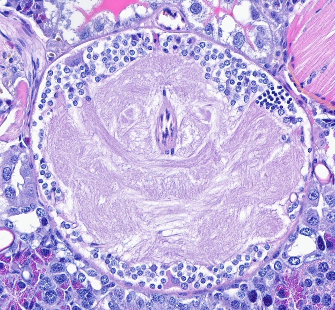 CakePath's tweet image. Alright, we have this cutie 🥰 ! 
I now have a better idea of the potential organ identification from this entomological autopsy. #pathology #pathologists #pathTwitter #dermpath #dermatologia #dermtwitter #entomology