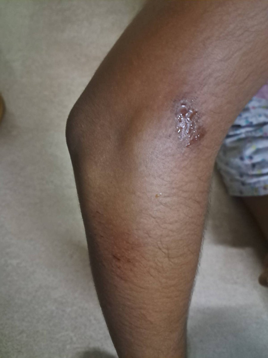 Gokul Krishnamoorthy tweet media