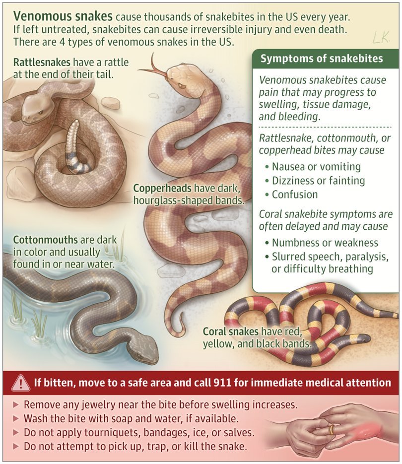 EddieRDMD's tweet photo. 🐍JAMA: Only ~5-10 people die yearly in the US from venomous snakebites! 📉
📝 This Patient Page covers US venomous snakes, symptoms, treatment & prevention tips 🩹🚫 Stay safe out there! 🌿 #SnakebiteFacts
Journal: https://t.co/5SaPBVGg9u @_atanas_ https://t.co/mqsx327Gjg