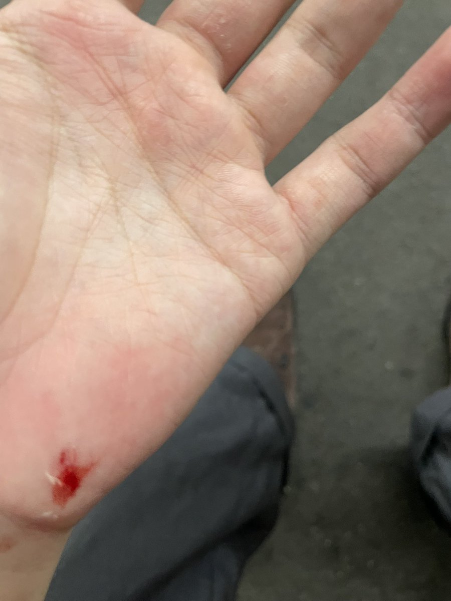 imoimooimo_____'s tweet photo. 大事なズボンは破け、手からは出血
トドメに電車の遅延で夜行バスを逃し大欠損したﾆｷ https://t.co/iaQiha8Fz5