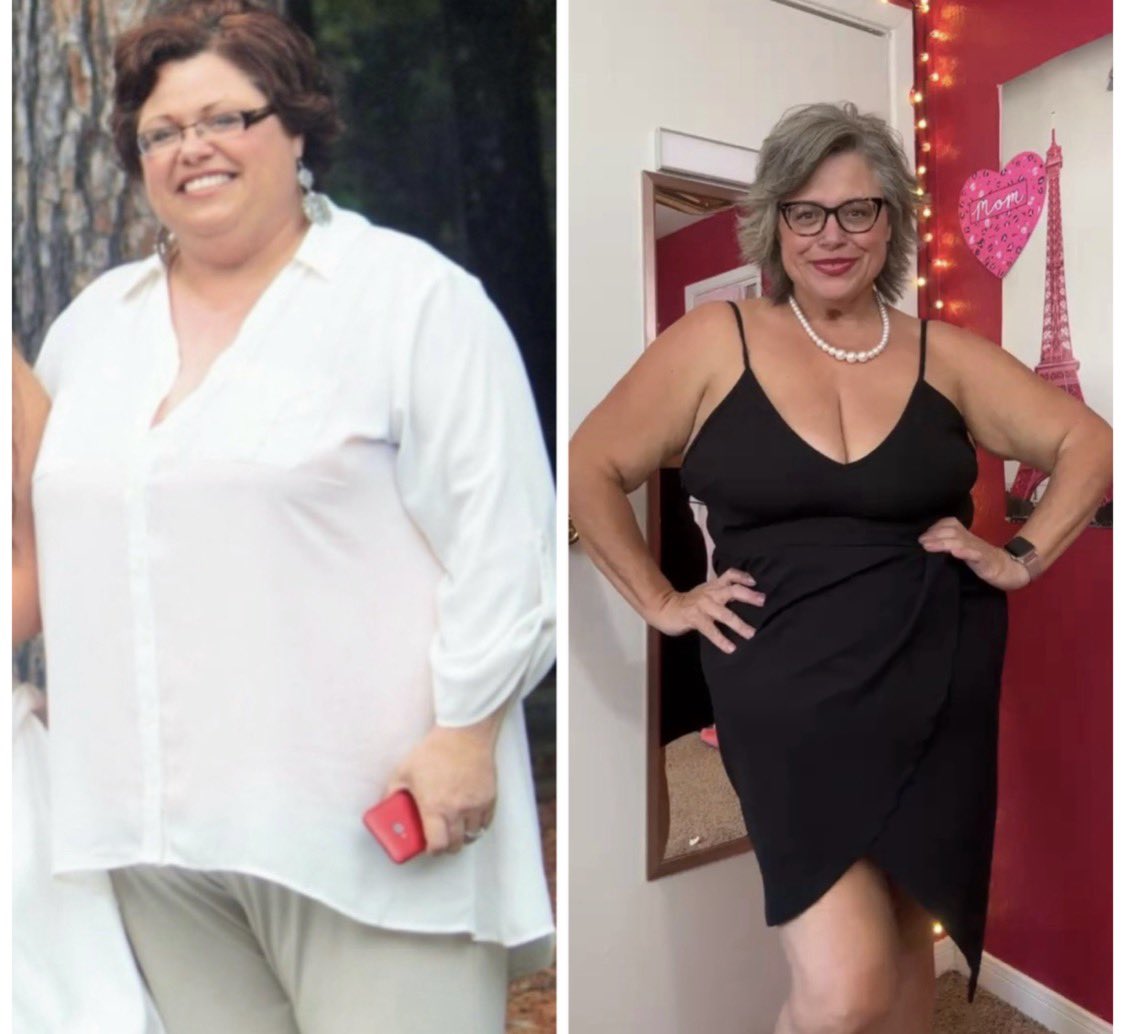 MissB53's tweet photo. Yes, obviously zero carb doesn’t work! I mean, that’s what all the “experts” say right? 

“ Your body needs carbs for energy”. 

“Low carb diets wreck your metabolism”. 

“You can’t get fiber without carbs, and that will ruin your gut”! 

“It’s all water weight”!  

When in reality, I went zero-carb Carnivore eight months ago. I’ve lost 111 pounds, reversed type 2 diabetes, stabilized my blood pressure, healed my metabolism, balanced my hormones, and reversed insulin resistance, depression, and anxiety.

I have more energy than I’ve had in decades. My gut runs like clockwork. My digestion isn’t just better—it’s healing.

It’s funny because none of the so-called “experts” ever seem to factor in real-life experiences. They ignore the tens of thousands, maybe even millions, of people who are healing themselves without doctors, without meds, and without carbs.

I’m not saying carbs are evil. I’d never say that. But for me, creating an environment without carbohydrates, where nothing could interfere or cause damage, let the nutrients I was eating actually do their job.

And it’s wild how all those “chronic conditions” disappear once you remove the bullshit. 

I will continue to prove them wrong 👑