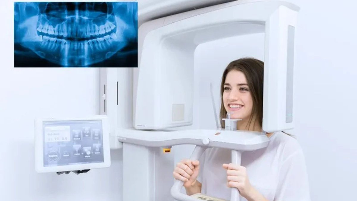 maximuspaul06's tweet image. Experience crystal-clear diagnostics with advanced digital X-rays in Scarborough, ensuring safer, faster, and more accurate dental care. 

maps.app.goo.gl/6wDKwPX7FMVkHA…

#MarkhamGatewayDentistry #ScarboroughDentist #DigitalXRays #ModernDentalCare #HealthySmile