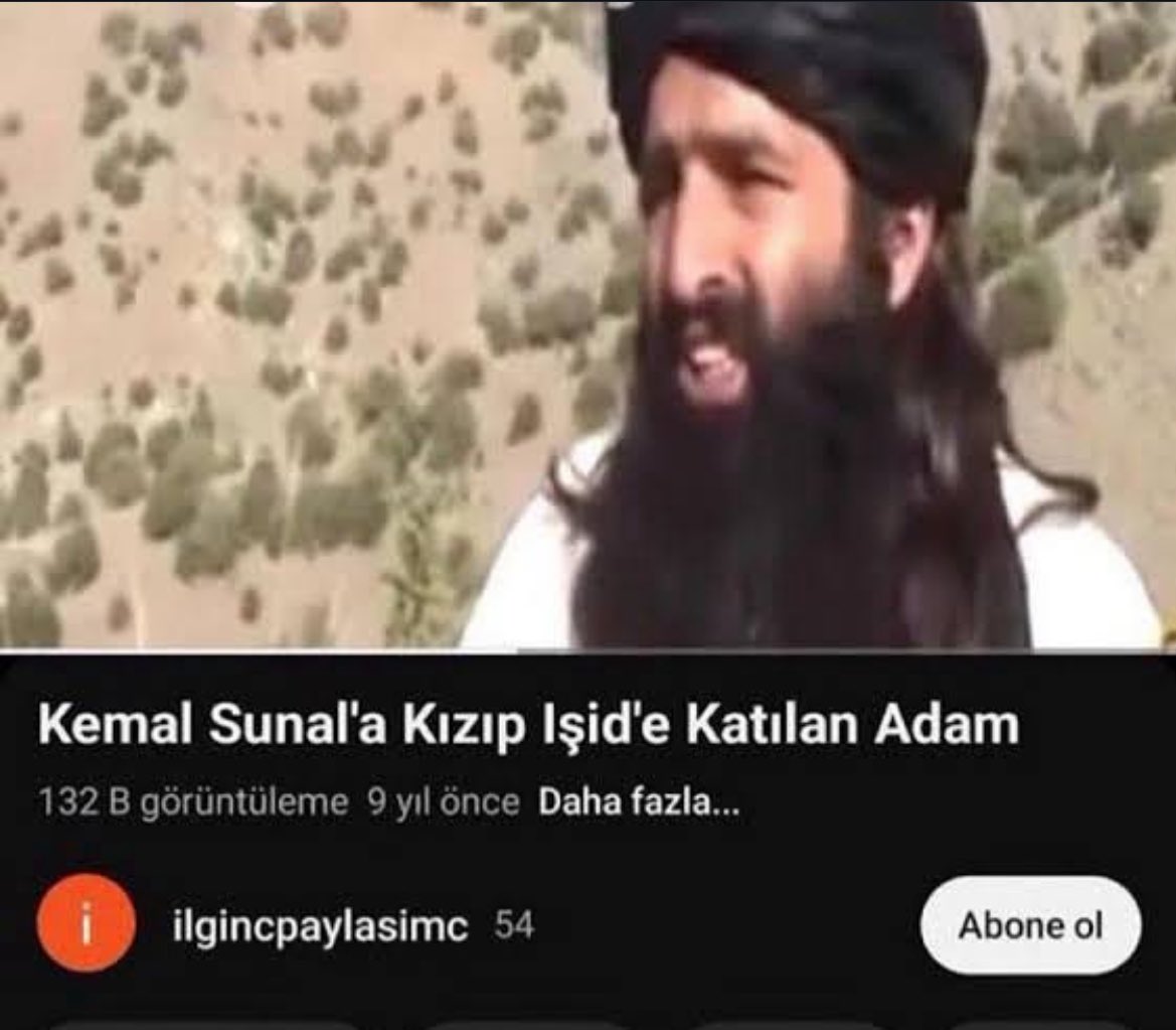 vizelere calısmamak icin bahane üretirken