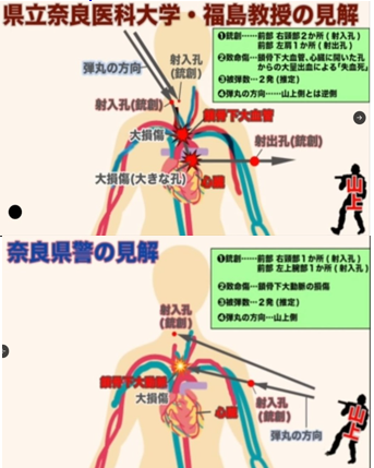shoetsusato's tweet photo. 救命医と司法解剖の結果に大きな齟齬。安倍元首相の搬送先で治療にあたった奈良県立医科大学附属病院の福島英賢教授は、事件当日の夕方に行われた会見で「首2ヵ所（正面と少し右）に銃創」「心臓には弾丸による大きな穴」「死因は心臓及び大血管の損傷による心肺停止」などと説明。  
一方、事件翌日に公表された奈良県警の司法解剖の結果は「首の右側1ヵ所と左上腕部1ヵ所に銃創」「心臓には銃撃による穴はない」「死因は左上腕部射創による左右鎖骨下動脈損傷に基づく失血死」とのことだった。
即死であった新たな証拠2025/10/27司法記者クラブ記者会見で明らかになった。山口敬之氏の会見で、奈良県警司法解剖会見が完全に捏造である証拠が公開されました。
下記の動画を視聴して、何が真実であるか見極めてください。今、日本の司法で前代未聞の恐ろしい茶番裁判が開始されています。  
 山上単独犯説はあり得ない　  記者会見のフル動画です  ■現場での死戦期呼吸ありの証言（失血死でなく現場で即死） ■山上銃弾が議員バッジを粉砕したとする音の記録なし（警察のウソ） ニコニコ動画アドレス→ https://t.co/ERMPlM2iiT