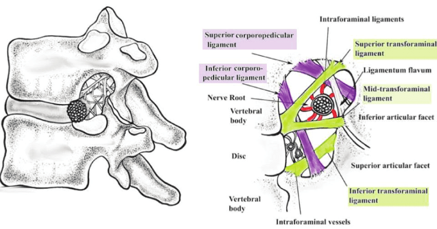 IvanGHMD's tweet photo. The transforaminal ligaments were thought to be a cause of low back pain, but now are known to be normal anatomic structures that help hold components of the neural canal in place. https://t.co/PFvN2JRfkX