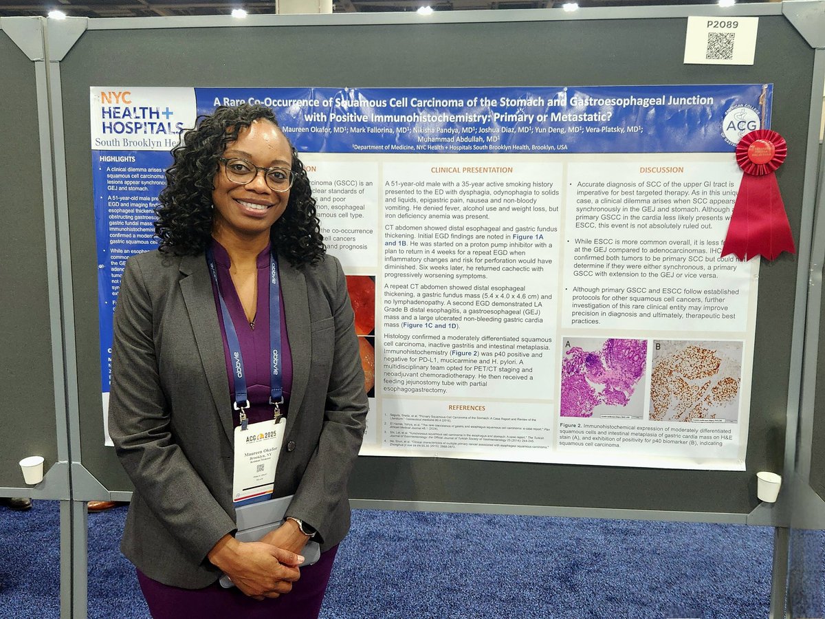 okaformo's tweet photo. Honored to receive Outstanding Poster Presenter Award for our poster on primary gastric SCC at #ACG2025 this week. Heartfelt thanks to my amazing co-authors, colleagues and mentors, @AmCollegeGastro, @blackingastro, @SouthBKHealth and for new friends made! #GITwitter #MedTwitter https://t.co/GchUJMoJSZ