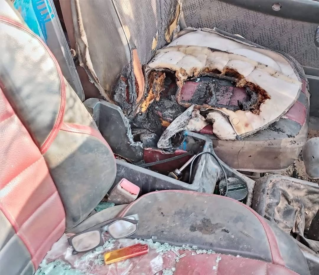 He’s now in the ICU

Israeli jewish settlers kidnapped, beaten and burned this Palestinian man in the occupied West Bank..