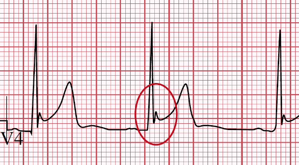 CardiovascularCorner tweet media