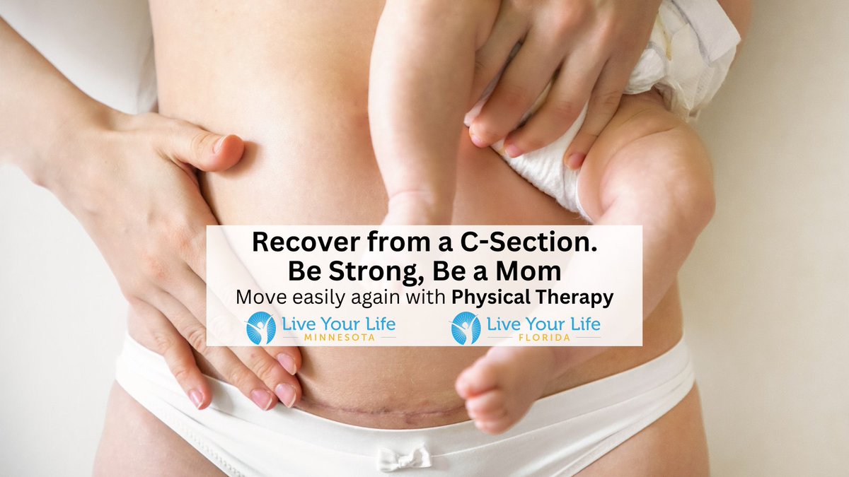 LiveYourLife_PT's tweet image. You may be surprised how much you use your ab after a C-section. Physical therapy can support your recovery journey to help you be the strong, mobile mom you want to be. Check out our services here bit.ly/4bnZwwn #mom #csection #baby #abs #coremuscle #strong #wellness