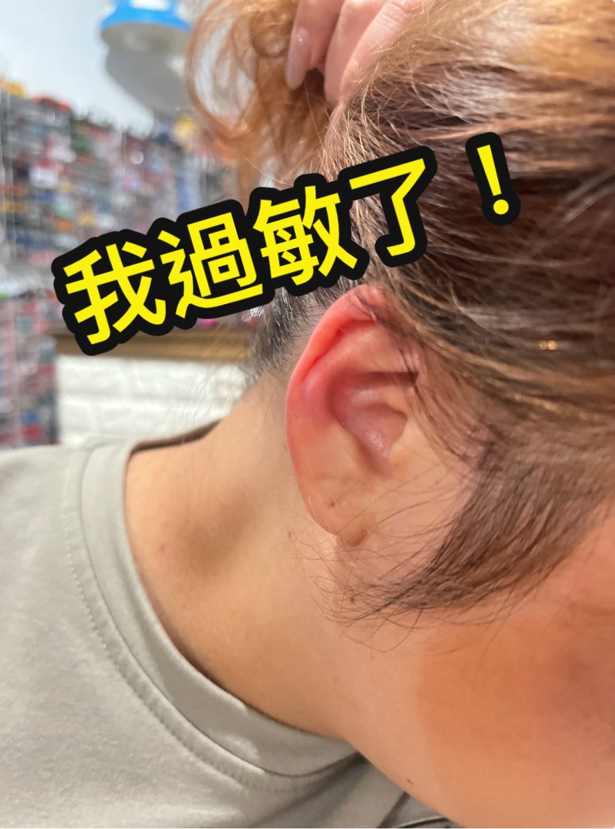 f_u_c_k_A11's tweet image. 莫名其妙吃個早餐不到幾分鐘開始四肢發燙刺痛，後來還發燒到39度，直奔急診吊點滴…...
醫生說：目前看起來是過敏反應，但你早餐
只有吃豬肉泡菜蛋餅，只有兩個可能「蛋過敏，不新鮮！」、「泡菜過度發酵壞掉了，食物中毒！」
好了，今年犯太歲真的慘麻煩留言安慰我😭😭😭