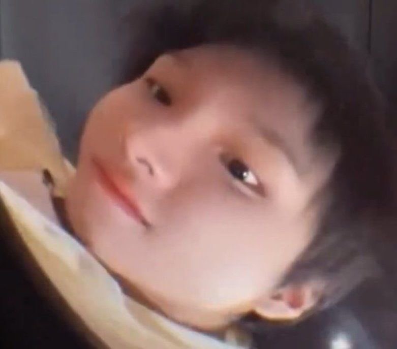 볼살 흘러내려요