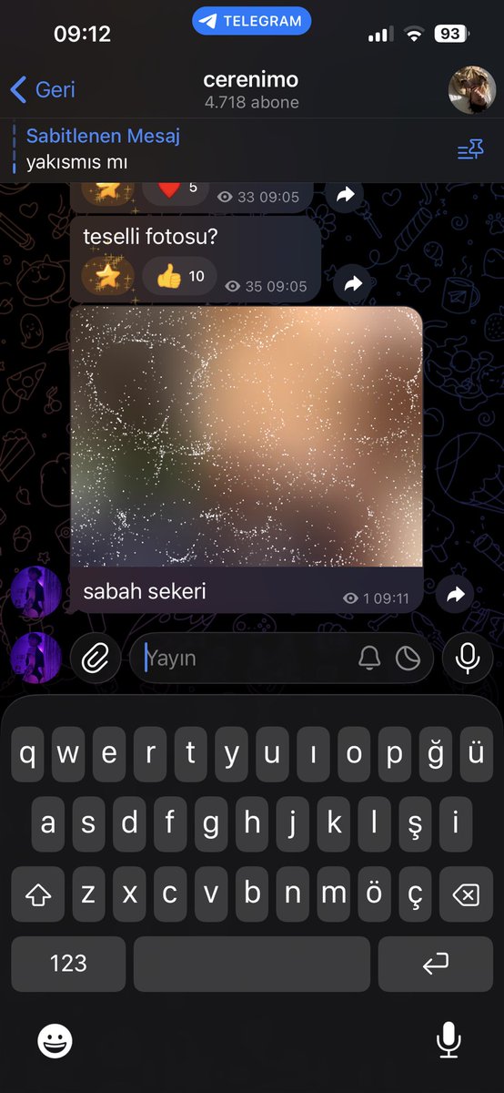 cerenimol1's tweet photo. iki tarafa da teselliyi attimmmm 

https://t.co/jSna1l3JVD https://t.co/I61bACWiUW