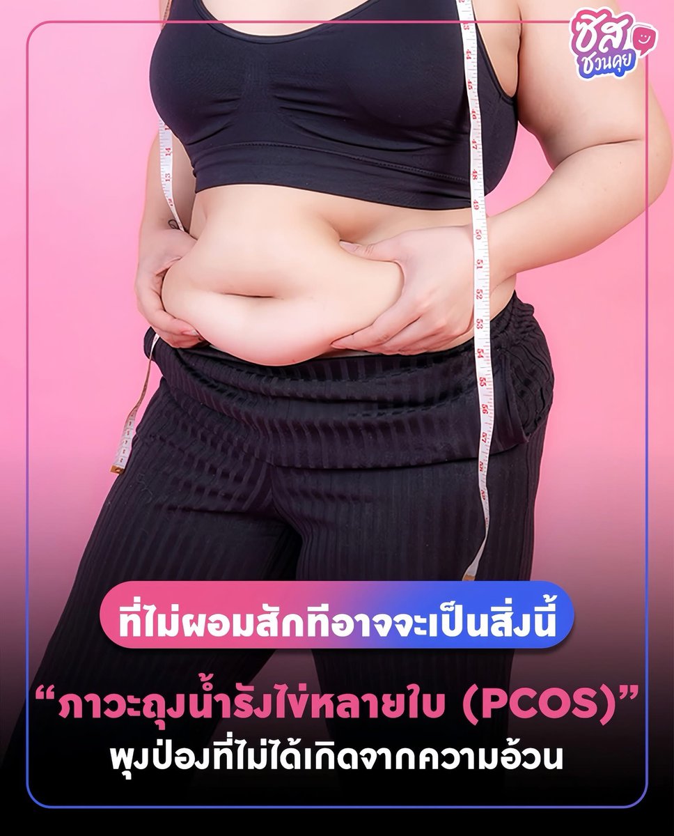 sishereth's tweet image. 📣 #ซิสชวนคุย ที่ไม่ผอมสักทีเราอาจจะเป็นสิ่งนี้ ภาวะถุงน้ำรังไข่หลายใบ 💖✨ พุงป่องที่ไม่ได้เกิดจากความอ้วน ภาวะถุงน้ำรังไข่หลายใบ หรือ Polycystic Ovary Syndrome (PCOS)
.
#PCOS #ภาวะถุงน้ำรังไข่หลายใบ #อะไรฮิตซิสรู้ #SisHere #ซิสเฮียร์