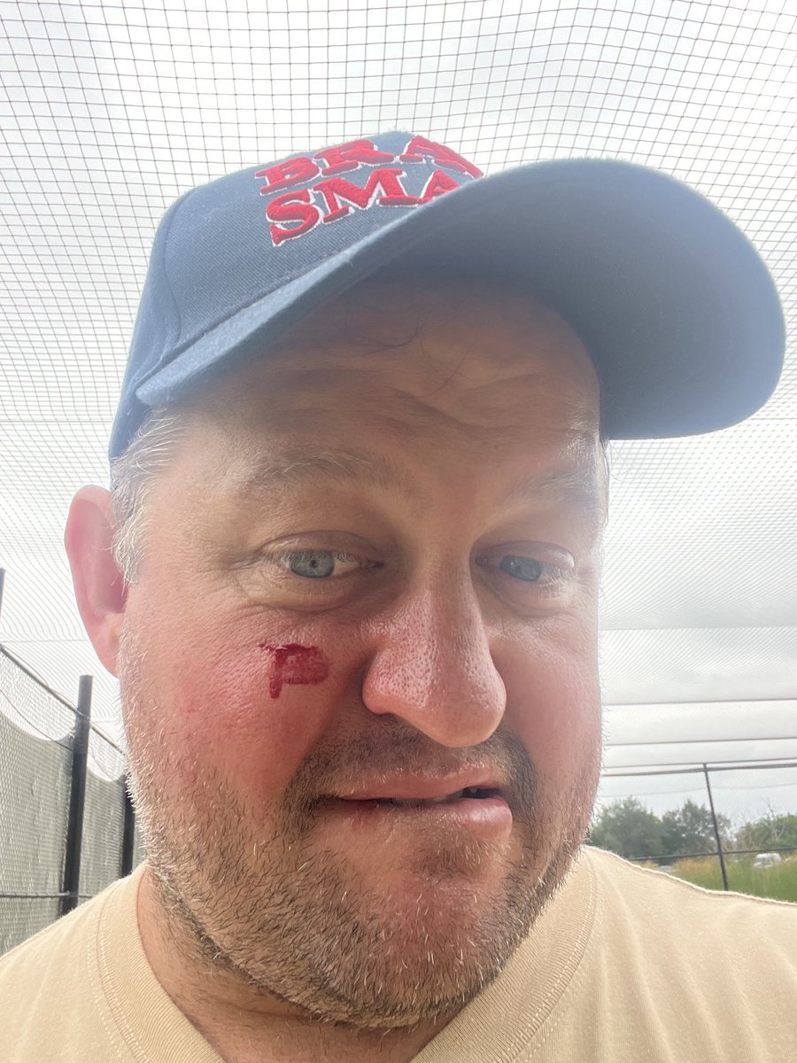 Came off on the wrong end of a top edge at the nets with Boss this morning 🏏 

We’re having a 😂 about it but fair dinkum wouldn’t have taken much to be a lot worse. Lucky I had my trusty ⁦<a href="/yarramanpark/">Yarraman Park Stud</a>⁩ ⁦<a href="/ausbloodstock2/">Australian Bloodstock Updates</a>⁩ Brave Smash hat on to protect me