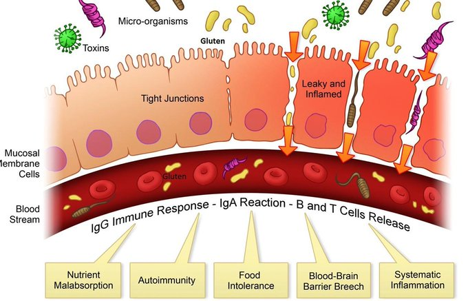 questmoosa's tweet photo. If you want beautiful thick hair, it would be an excellent idea to heal your GUT.

The gut can be a huge source of toxins that induce inflammation in the body.

Whether it's caused by an excess of pathogenic bacteria, fungus and/or leaky gut (90-95% of the time).

Pathogenic bacteria and fungi create toxins that inflame the gut. 

This leads to leaky gut allowing the toxins to be absorbed into the body and causing inflammation in every organ.

A few ways to improve leaky gut is to:

-Drink 1 cup of bone broth or a cup of milk with 1tbsp gelatin x2 daily

-Add 1 tsp glutamine with each cup of bone broth

-Get enough vitamin D (2000-3000IU daily)