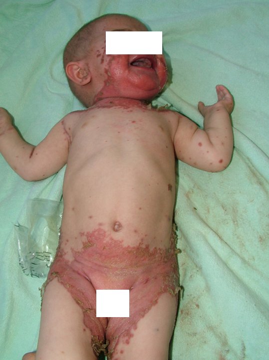 IhabFathiSulima's tweet image. What is the diagnosis?