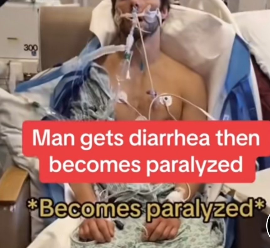 IhabFathiSulima's tweet image. Short scenario.
A Man Gets Diarrhea then become paralyzed.
What is the diagnosis?
What is the Differential?
What is the cause of Diarrhea?