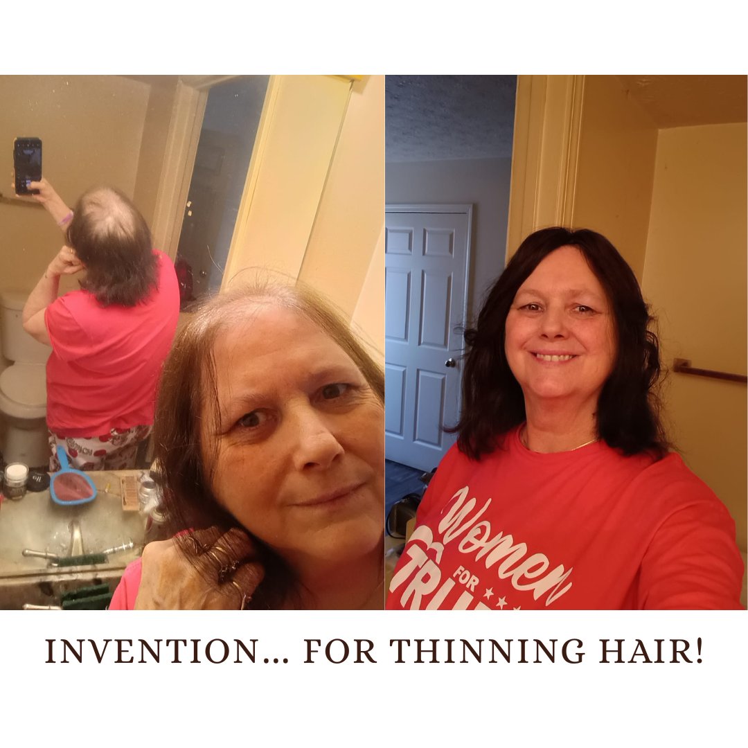 MicroStrand's tweet image. 𝐓𝐡𝐞 𝐩𝐫𝐨𝐨𝐟 𝐢𝐬 𝐢𝐧 𝐭𝐡𝐞 𝐝𝐞𝐭𝐚𝐢𝐥𝐬! 🤯
This is the incredible difference an InvisaBlend treatment makes for clients with thinning hair loss. 
#ThinningHairSolution, #InvisaBlendResults

[𝗙𝗥𝗘𝗘 𝗣𝗿𝗶𝘃𝗮𝘁𝗲 𝗩𝗶𝗱𝗲𝗼 𝗗𝗲𝗺𝗼] 👉 bit.ly/44sWuDq