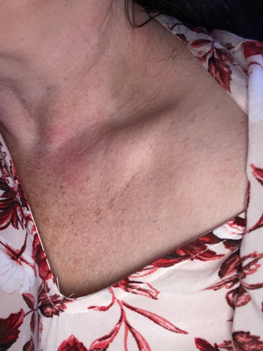 So, einen schönen Schlüsselbeinsonntag! 
(Alte Frau)