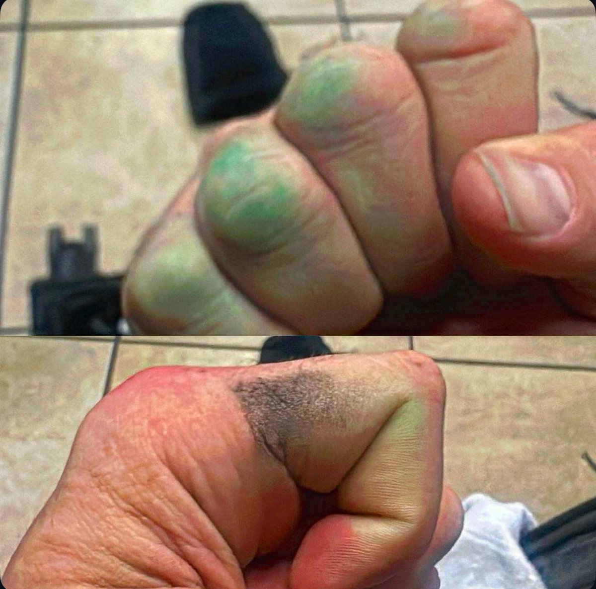 Got Iguana Blood on my fists again Last Night! 

<a href="/MrIguana/">Mr. Iguana</a> 
<a href="/luchalibreaaa/">Lucha Libre AAA Worldwide</a>