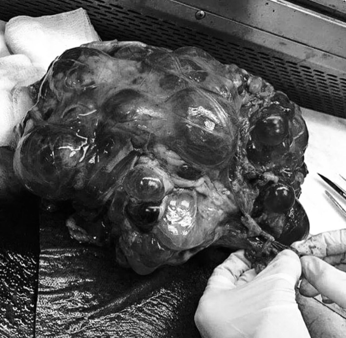 hemo_shk's tweet image. #Identify 
#Organ
#Diagnosis 

What pathological process occurred here?

#MEDHM #MedX @IhabFathiSulima