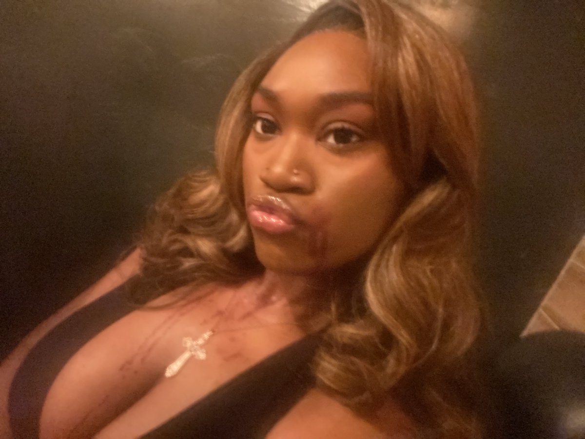 before and after i bit some neck 🙂‍↕️