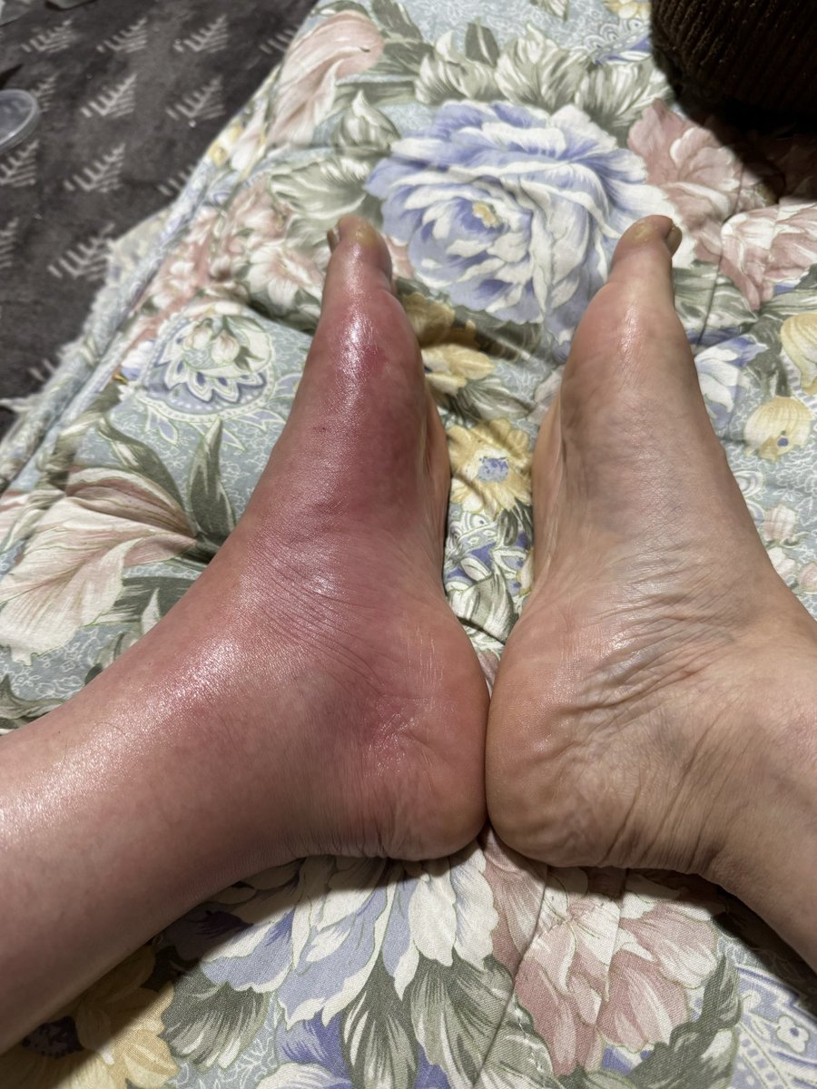 🔰ナッチ(レッド)サービスサービス🎶😅🔰 tweet media