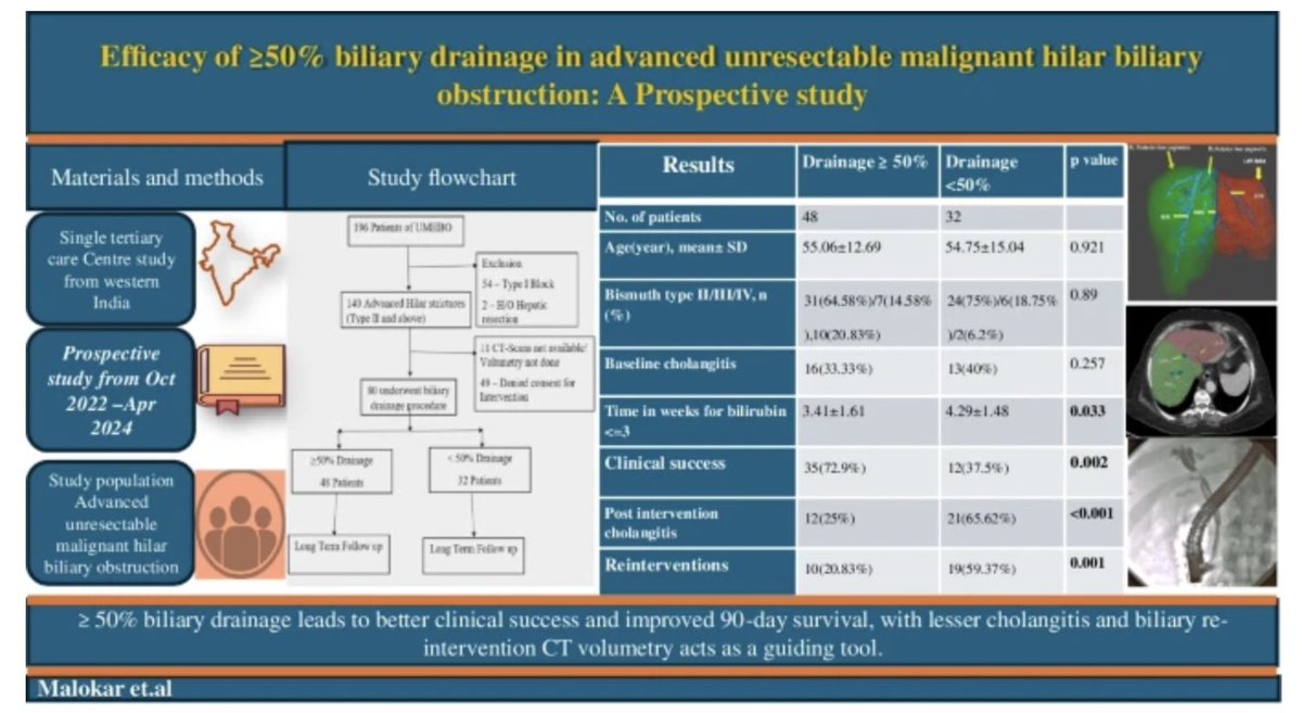 IJG_Journal's tweet image. Efficacy of ≥ 50% biliary drainage in advanced unresectable malignant hilar biliary obstruction: A prospective study

Rishikesh Malokar @sanjy_med et al

Team Nair 

link.springer.com/article/10.100…