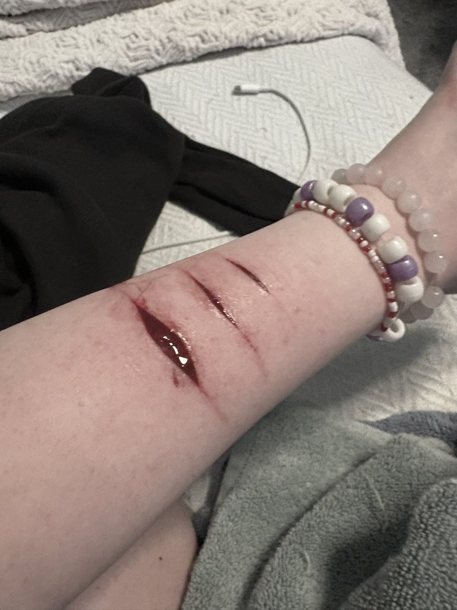 jestercultz's tweet image. It’s covered with blood but hit beans (I think, I saw the tissue) today!! &amp;gt;_^ #shtwt #shedtwt