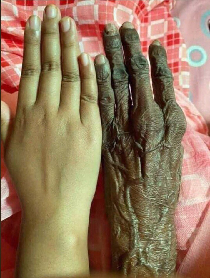 Be humble. Just a matter of time.