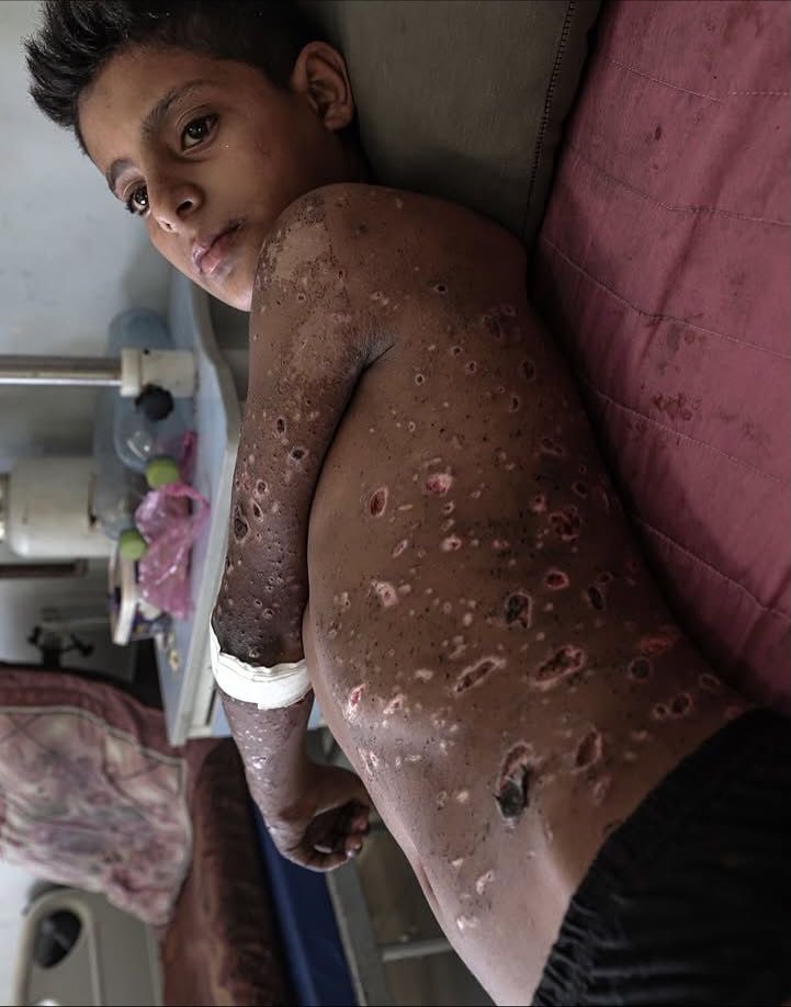 AbujomaaGaza's tweet image. Imagine this your son!
Gaza 2025 — two years of continuous Israeli genocide..