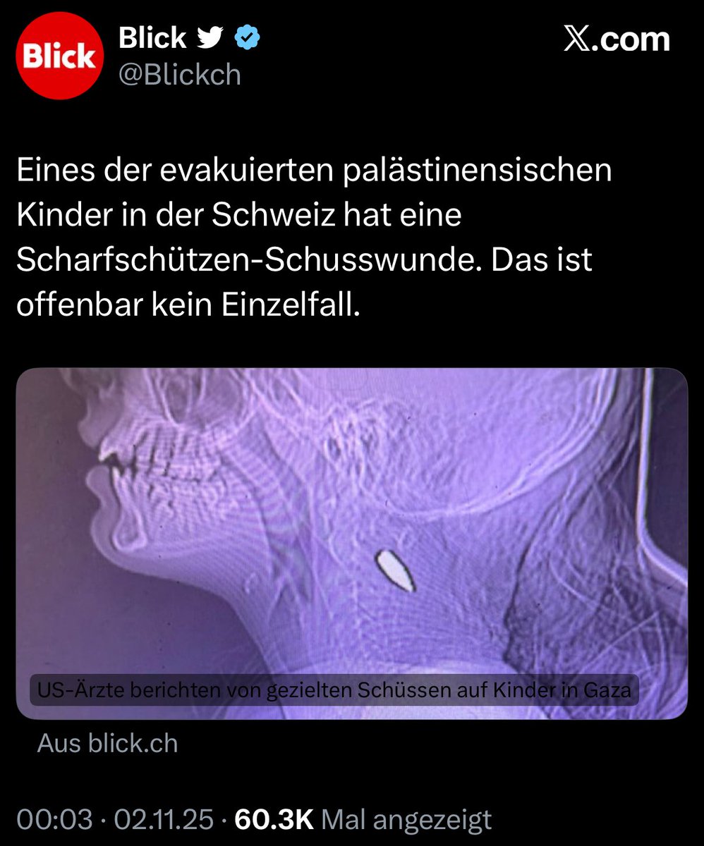 Der Blick verbreitet derzeit ein Bild, das angeblich ein verletztes Kind zeigt, das in die Schweiz gebracht worden sei. In Wahrheit handelt es sich um ein Röntgenbild mit einer Kugel im Hals, das nichts mit der Schweiz zu tun hat.

Es ist längst belegt: Die Hamas nutzt