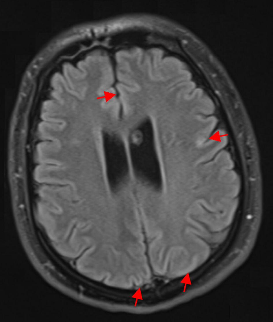Journal of Neurology Research tweet media