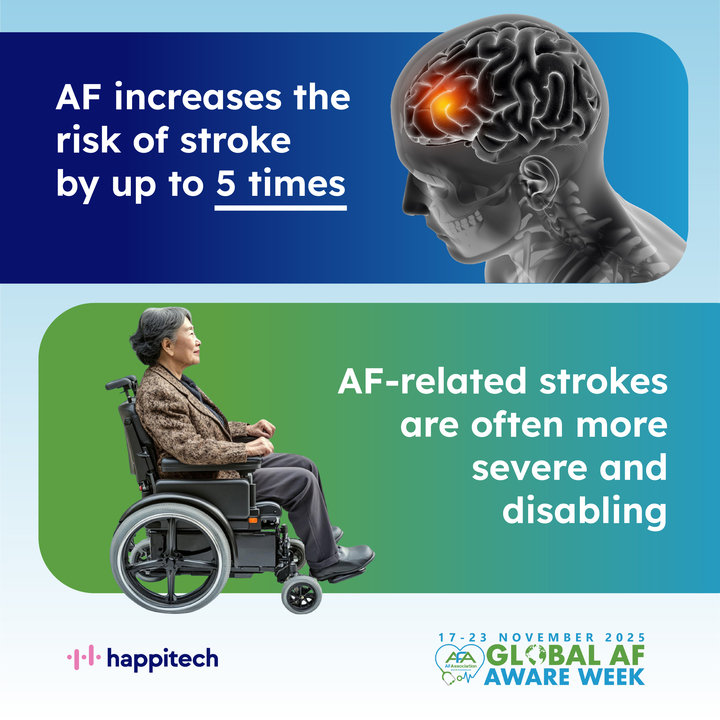 Happitech - smartphone based AF detection tweet media