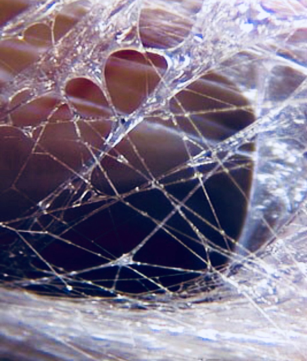 PullTheShade3's tweet image. #fascia or #spiderweb