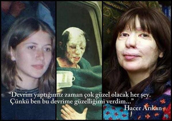 TravisWeird's tweet photo. Bazı yüzler bakıldığında insana tarihini tokat gibi hatırlatıyor ve içinde derin bir sızı bırakıyor. Bu yüz de hiçbir zaman akıllardan çıkmamalı https://t.co/FMI4IBQSKS