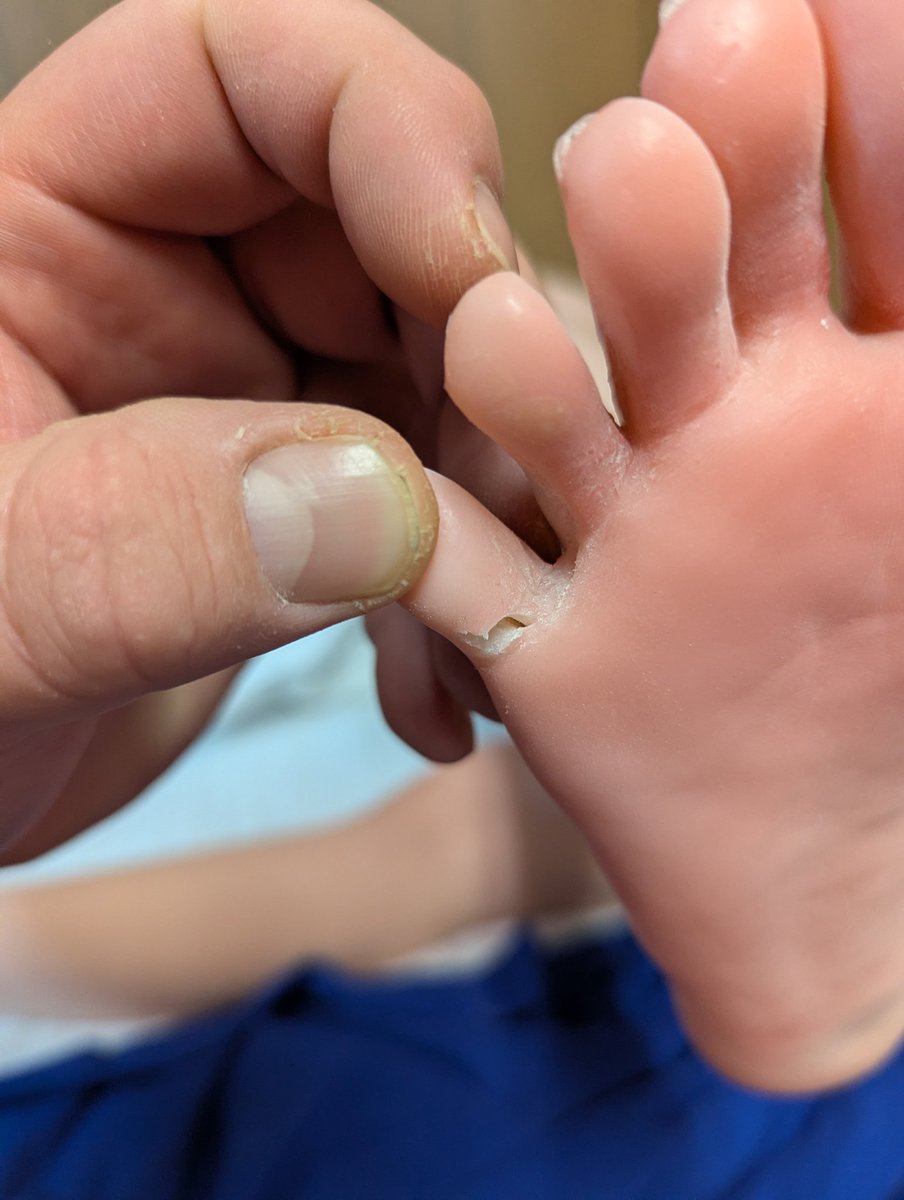 DelorianDavid's tweet photo. Really can't say I would recommend Evasdoll I'll accept that I possibly ruined the feet a bit because she was constantly standing, but it's unacceptable to have an armpit tear like that happen, especially because I hardly moved the arm beyond a 90° angle. https://t.co/aKwFicmpAD
