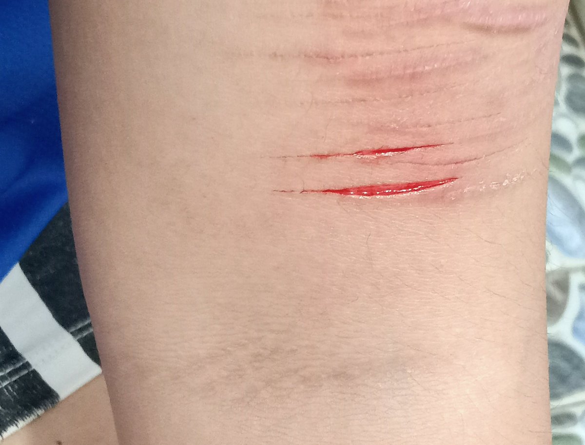 dgh0407's tweet photo. nhỏ nhỏ cu te đồ đó #selfharms https://t.co/jWrQCQqyQL