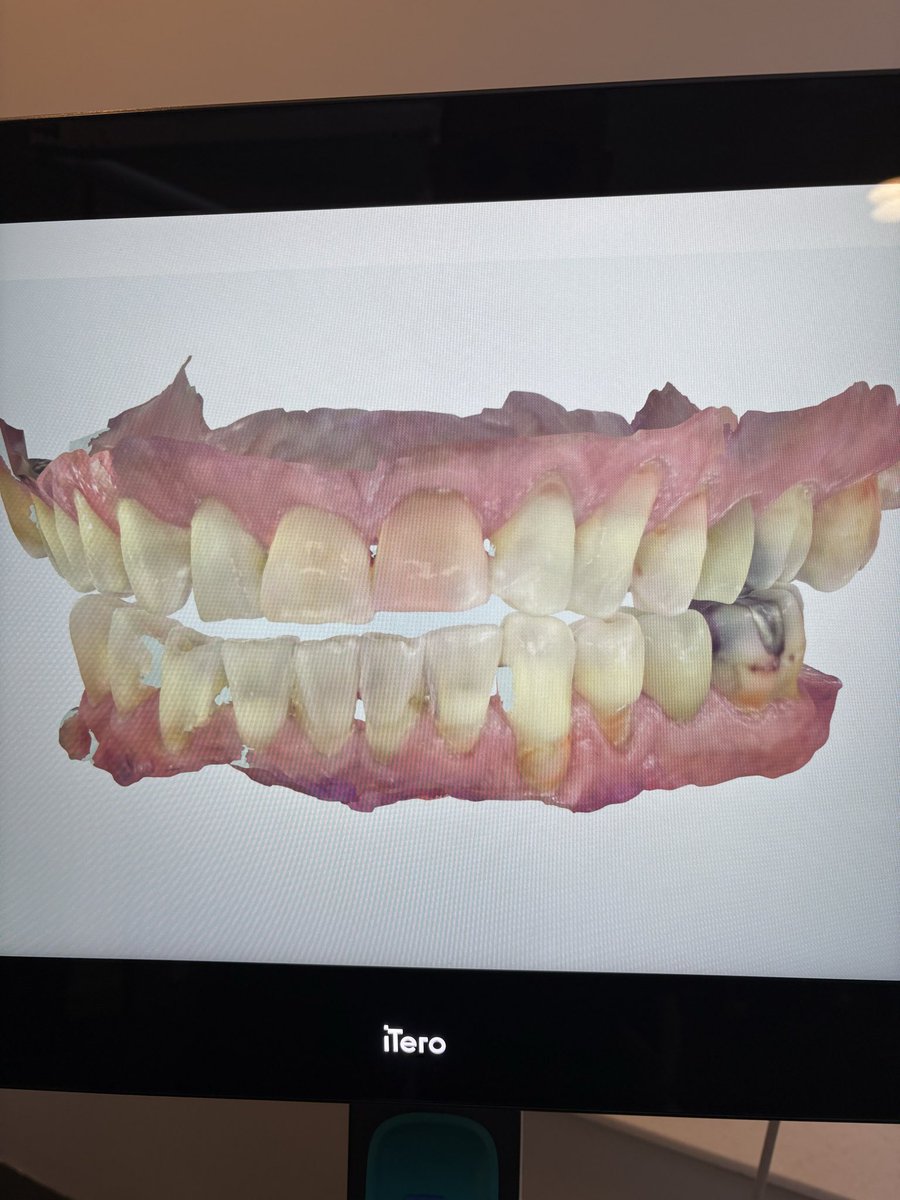 Tommy Cummings tweet media