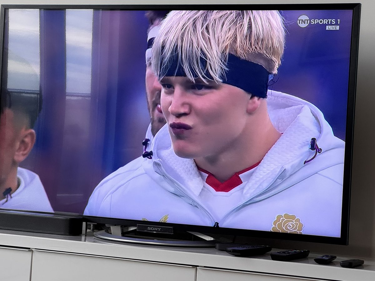 When you order Bobby Skinstad off Temu.