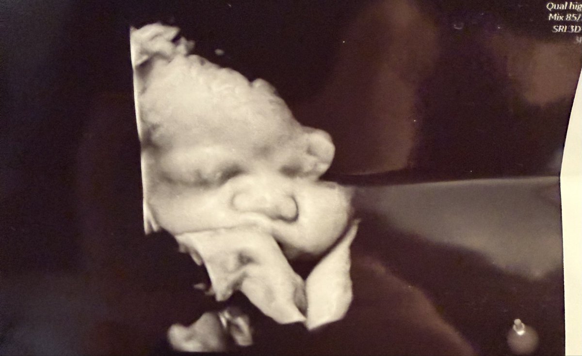 Coop⏱️ tweet media