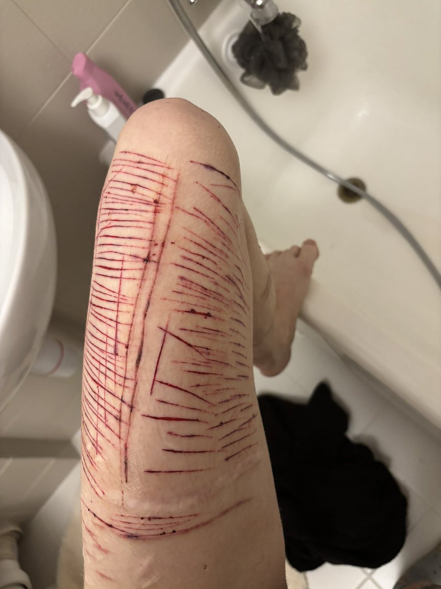 p4in_kitty's tweet photo. #styro #styrotwt #sh #shtwt #styrofoam #styrostwt #988shtwt #988twt https://t.co/OASzHtUlbI