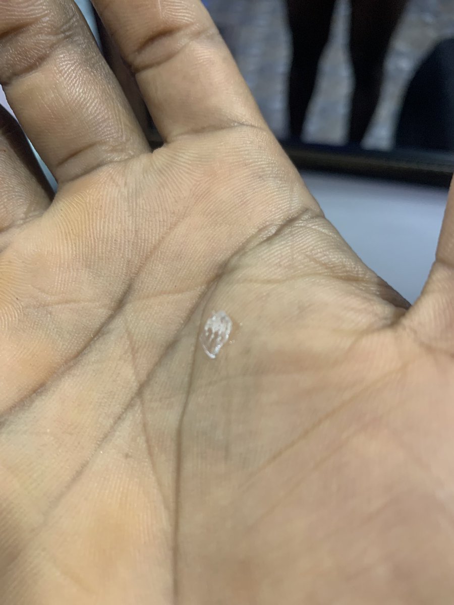 Please can I sue these people?

I was about to apply Vaseline this evening and as I was rubbing my hands together, I had a cut on my ring finger.

There was a broken bottle piece in the cream and the cut is deep.

Abeg! Can I sue the Vaseline Nigeria brand?