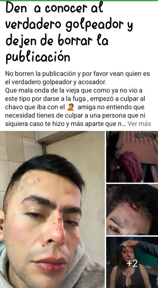 MichellTellez14's tweet photo. @c4jimenez @FiscaliaCDMX @BJAlcaldia Este es el verdadero agresor, dejen de echar culpas sin saber y conocer los verdaderos hechos https://t.co/m4BcL095qW