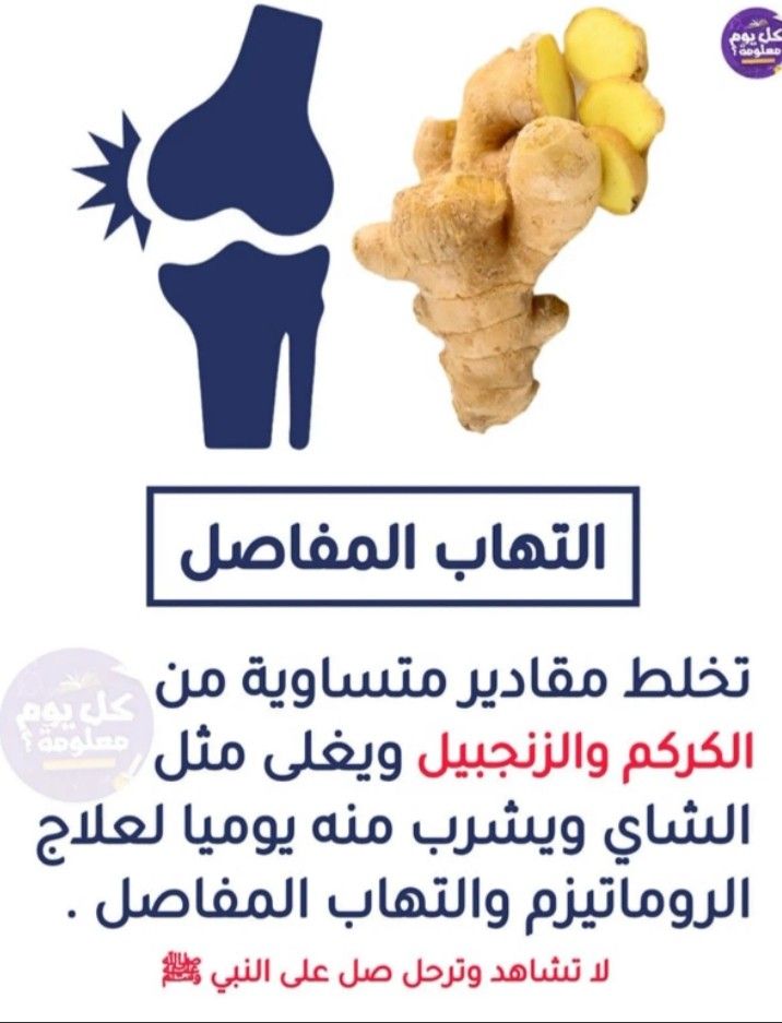 علاج التهاب المفاصل