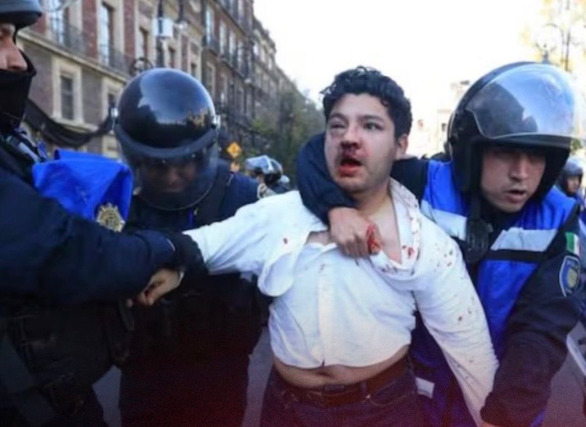 Así es como este gobierno trata a los jóvenes que alzan la voz por la inseguridad y por un futuro que sienten arrebatado. Si con esa dureza enfrentaran a los criminales, viviríamos en otro país. 

Pero no: a los delincuentes, abrazos; a los ciudadanos, represión.