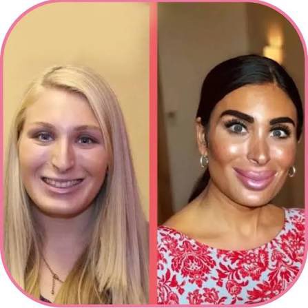 <a href="/LauraLoomer/">Laura Loomer</a> <a href="/RepThomasMassie/">Thomas Massie</a> Serious question and serious answers only.

How did Laura Loomer’s face melt away?

Did she stick her head in an air fryer? Is there a medical reason? 

Why is this such a mystery?

I find it so bizarre amd always have. Now there’s a woman that looks overcooked in the picture.