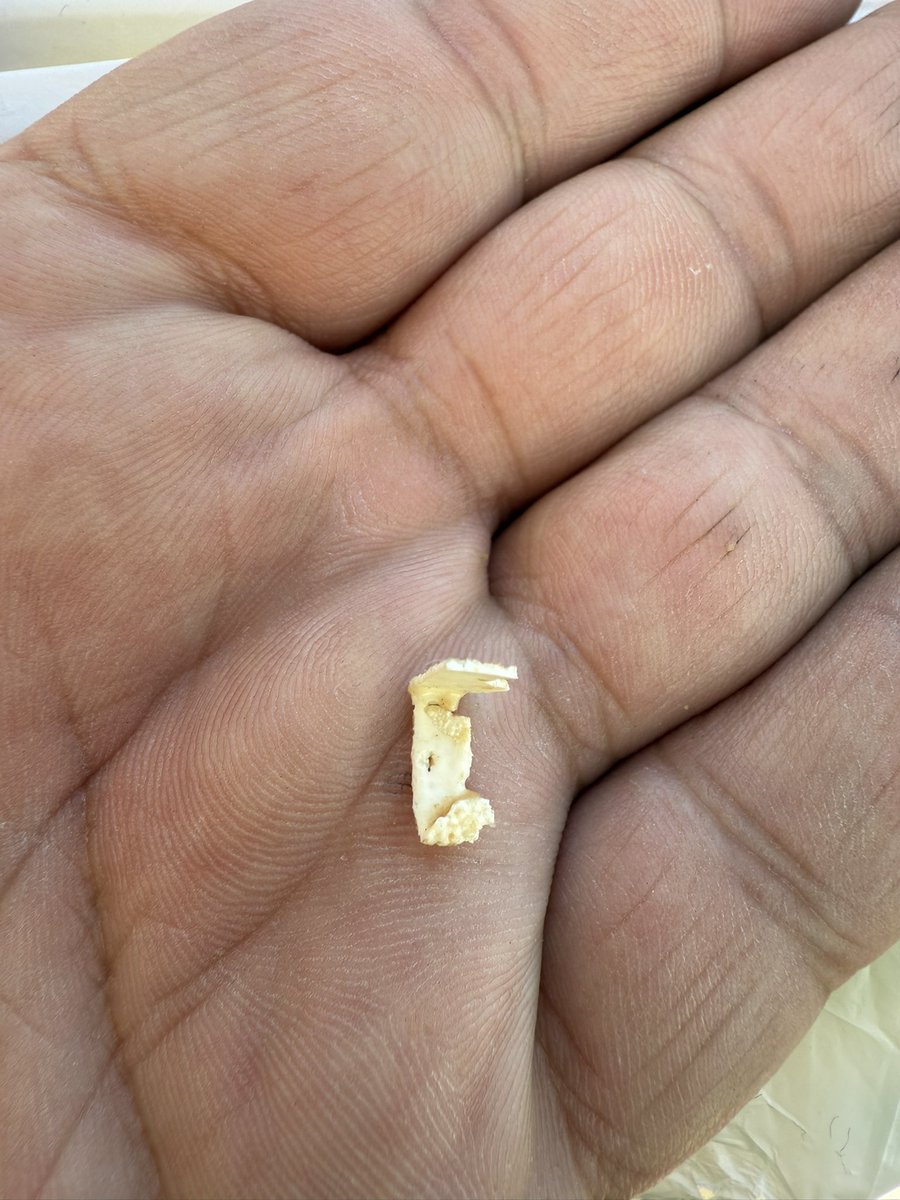 15 Kasım 2025 tarihinde  Silivri’de bulunan malum 3 harfli marketten satın aldığım #eti Burçak kurabinin içinden çıkan  nedir? millete ne yediriyorsunuz #eti #etiboykot #etiburçak #burçak  #gıda #sağlıkbakanlığı #sağlık #sbsağliklicozum #hijyen #ETI #ülker