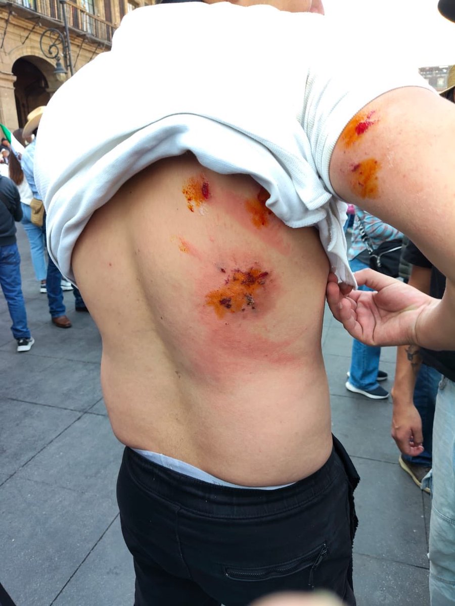 El gobierno calla ante la brutal represión contra quienes ejercían su derecho a protestar.

Brugada debe rendir cuentas y destituir a los responsables. Hay jóvenes heridos y el uso excesivo de la fuerza está documentado.

Solo falta que también normalicen la violencia de Estado.